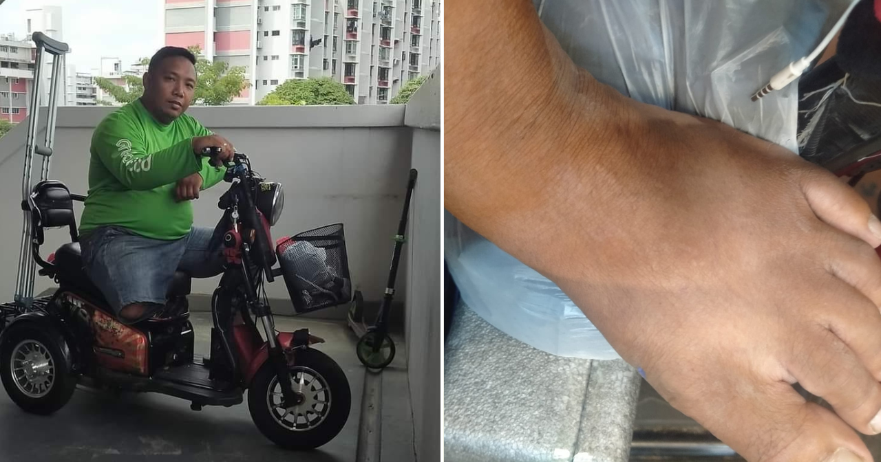 Amputee Delivery Rider Falls After Customer Makes Him Climb To 2nd ...
