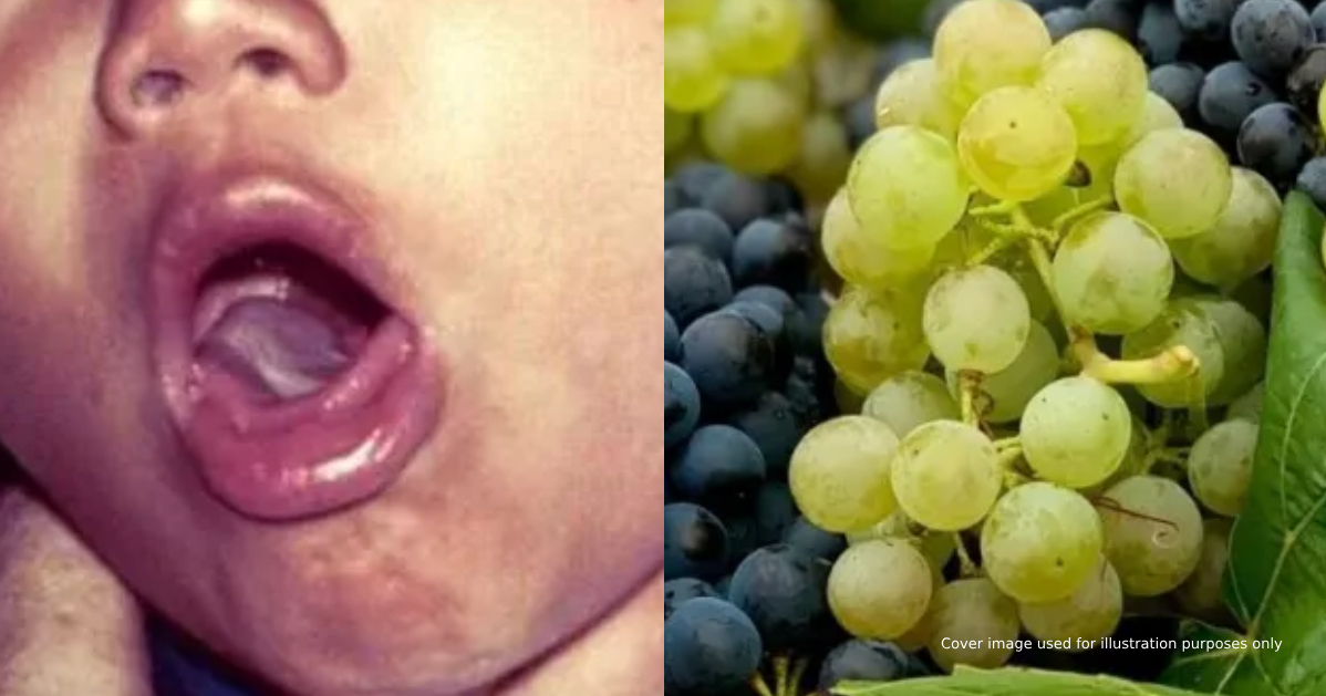 View of 2-Year-Old Melaka Girl Dies After Choking On A Grape