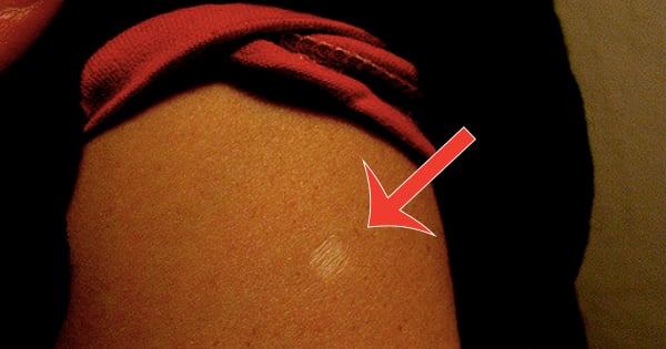 Why Most Asians Have This Scar On Their Left Arm