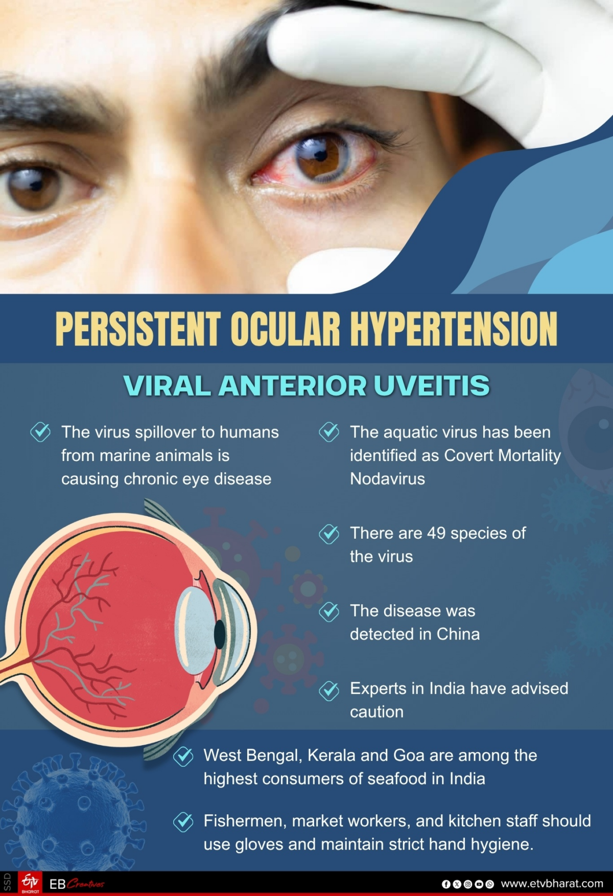 Researchers Discover Shrimp & Fish Virus That Can Infect Human Eyes